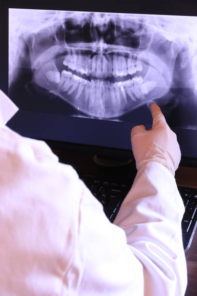 Best Emergency Dental Care for Sports Injuries in Parma, ID